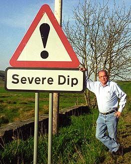 Severe Dip Sign